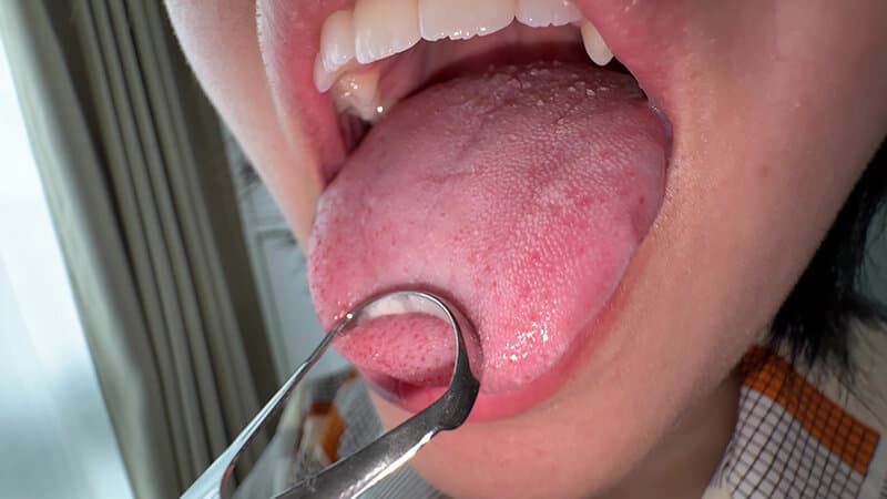 h_1651y00391 | 【個人撮影】加護まりの舌ブラシで「汚舌苔」採取 画像 5